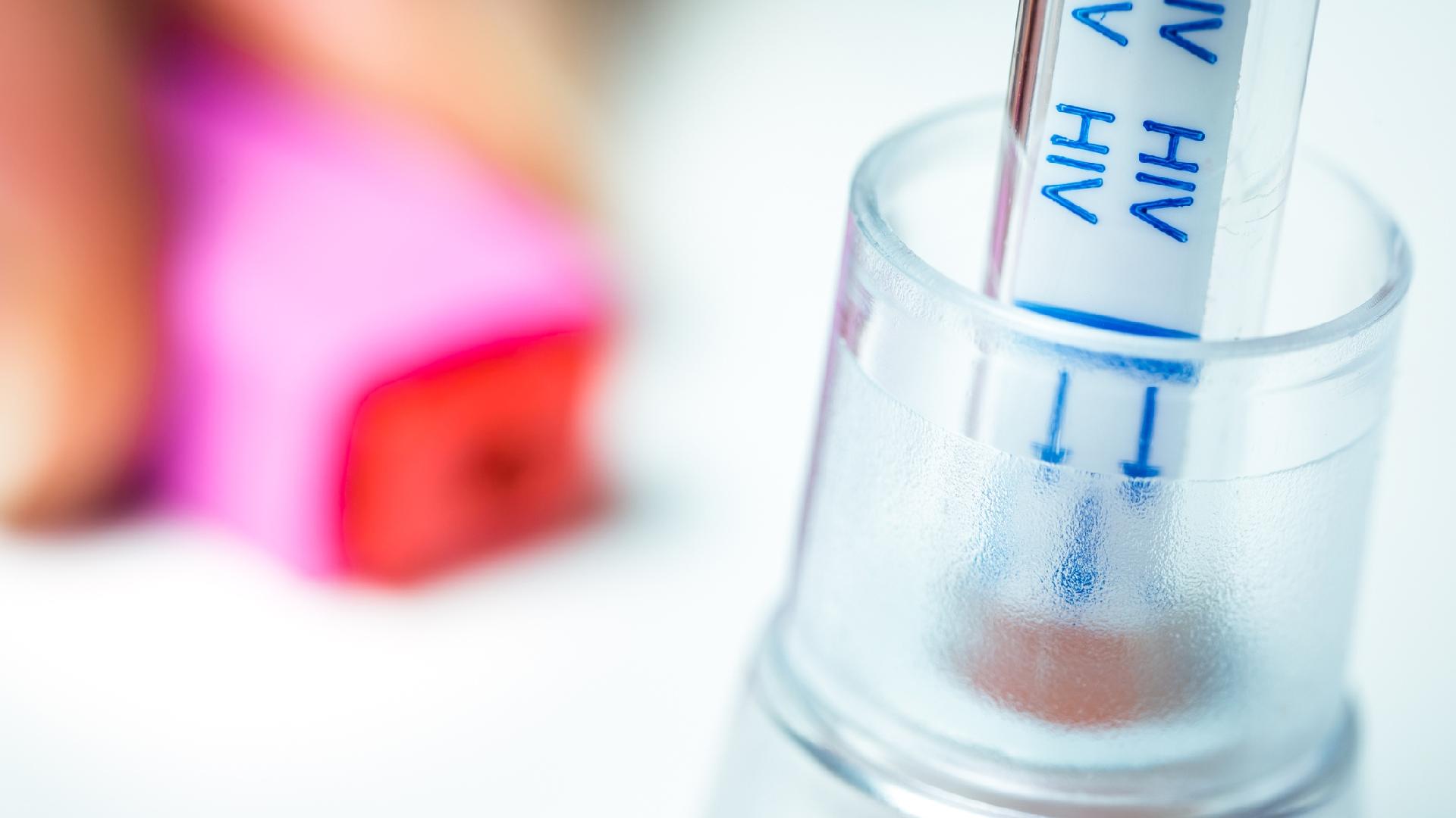 Показания к кариотипированию