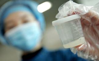 Увеличенное время разжижения семенной жидкости