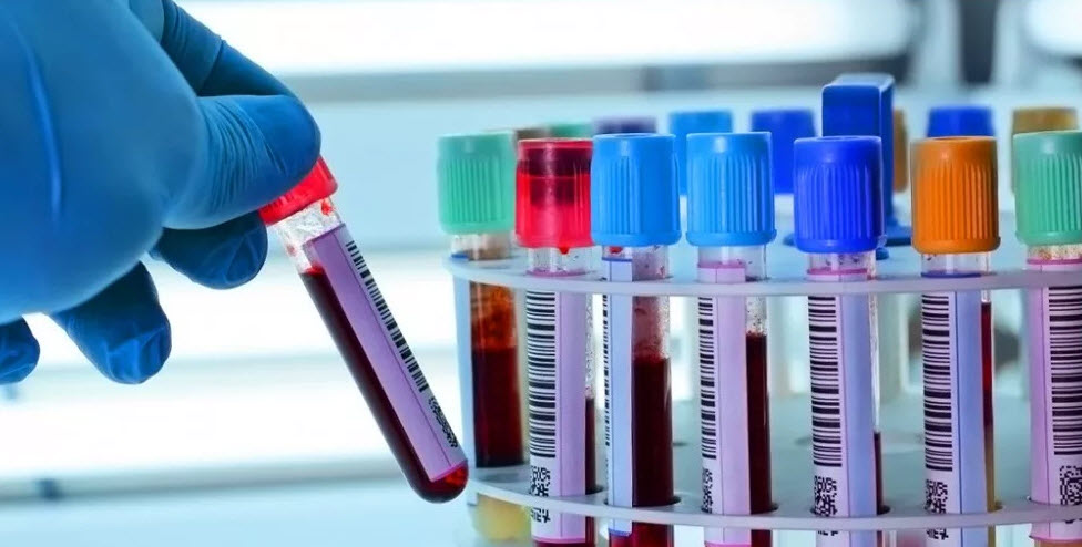 Длинный протокол ЭКО