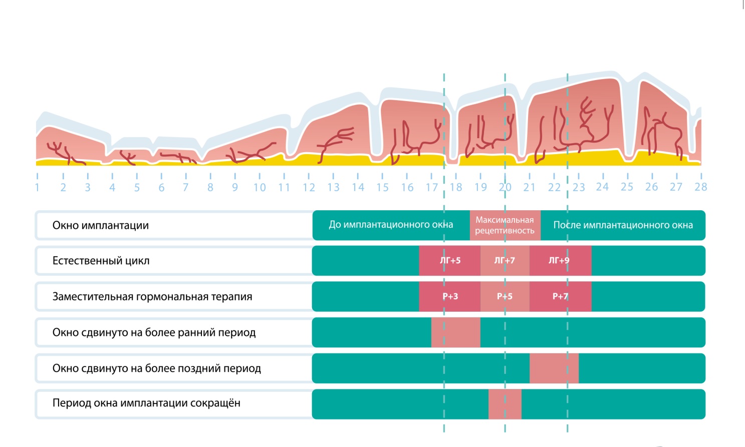 Исследование рецептивности эндометрия – Implatest