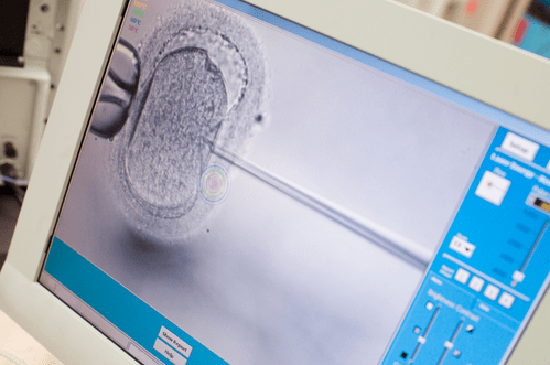 Процедура ИМСМ