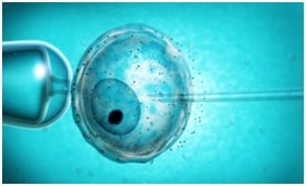 Подготовка к процедуре ИКСИ