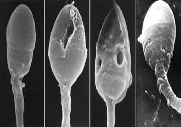 Отбор сперматозоидов